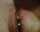 060115.eye1.v1_t.gif
